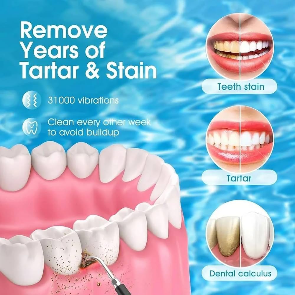 Sonic Electric Teeth Cleaner [Deep Cleaning]